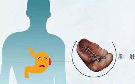 脾脏虚弱,脾脏虚弱调理之道